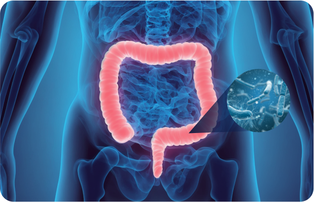 Colorectal Cancer and the Oral Microbiome